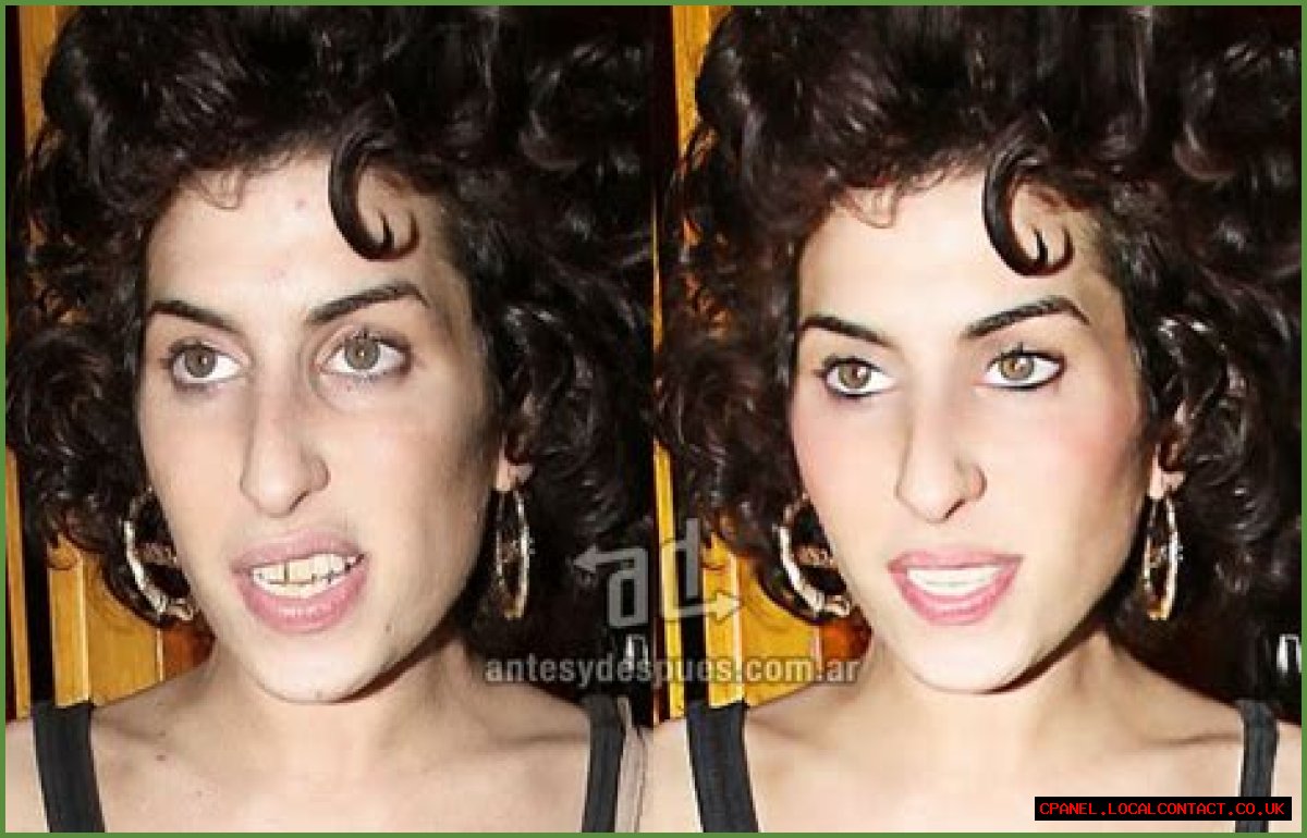 Amy Winehouse’s friends say she wants butt implants