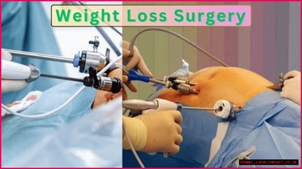 Discoveries Before Weight Loss Surgery