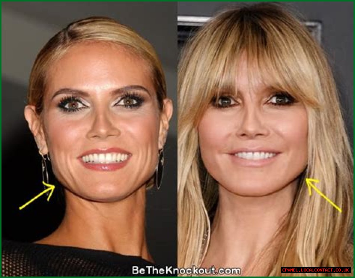 Heidi Klum: plastic surgery “doesn’t look pretty,   especially on young girls”