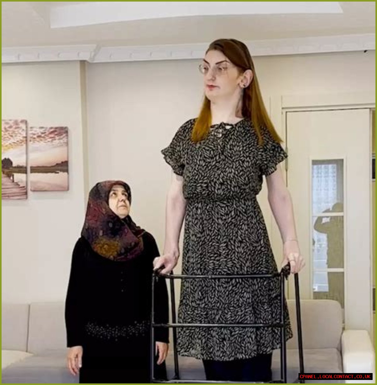 Tallest Woman in The World: Meet Rumeysa Gelgi, The World’s Tallest Woman, Who’s 7Feet Tall
