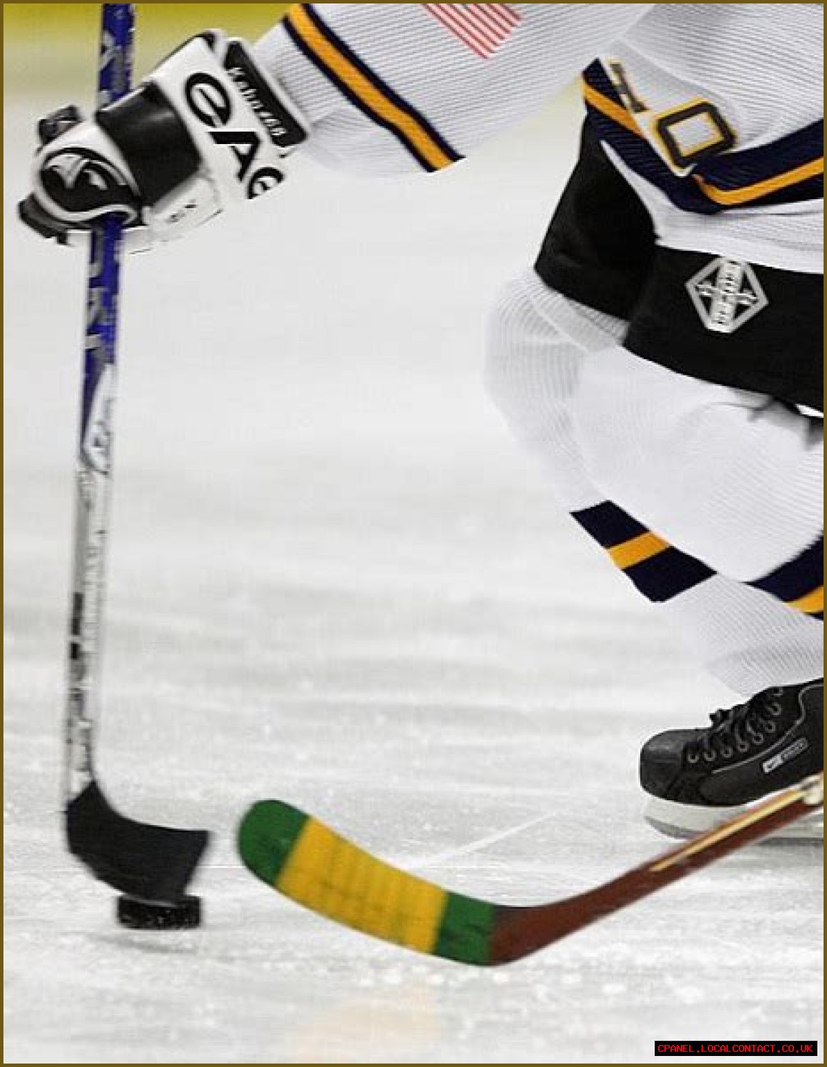 who was Teddy Balkind and what was Hockey Player cause of death?